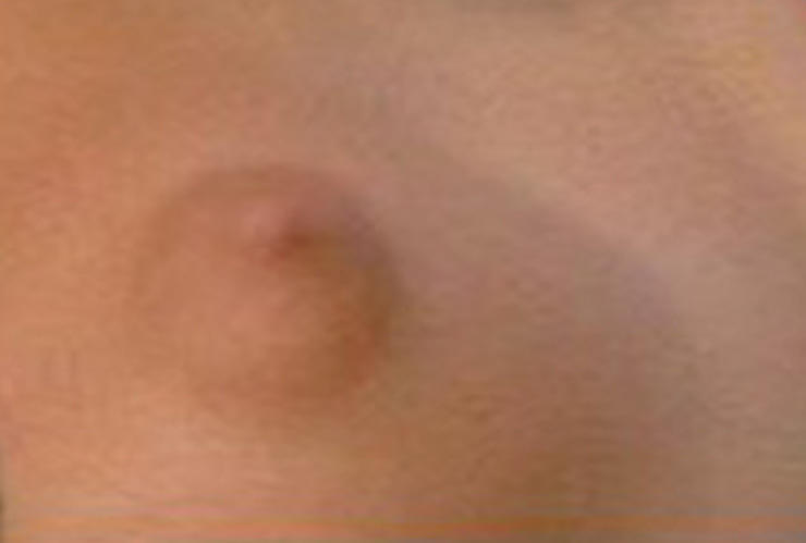 Guess That Celebrity Nipple 1032017 